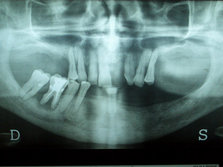 Radiografia della situazione iniziale