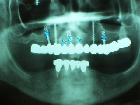 Radiografia della situazione iniziale