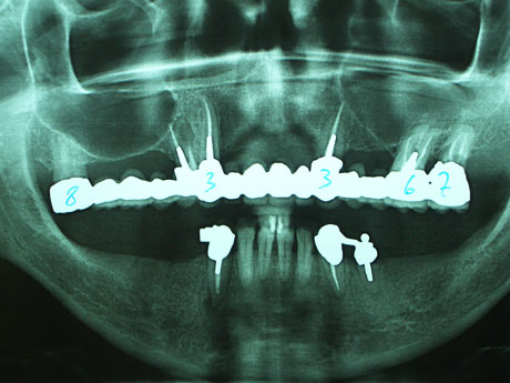 Radiografia della situazione iniziale