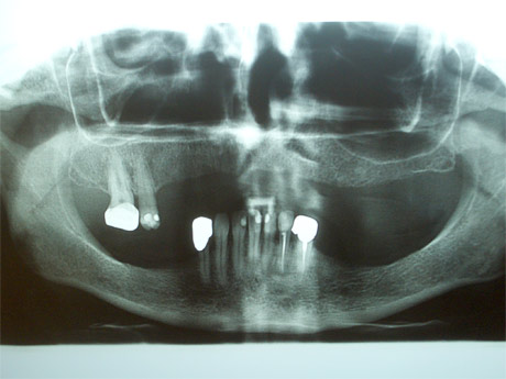 Radiografia della situazione iniziale