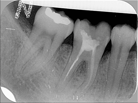 Radiografia della situazione iniziale