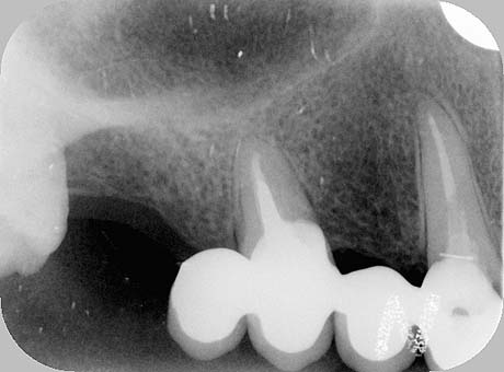 Radiografia della situazione iniziale: il ponte dal 12 al 14. Mancano il 15 e il 16.