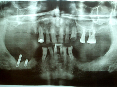 Radiografia della situazione iniziale